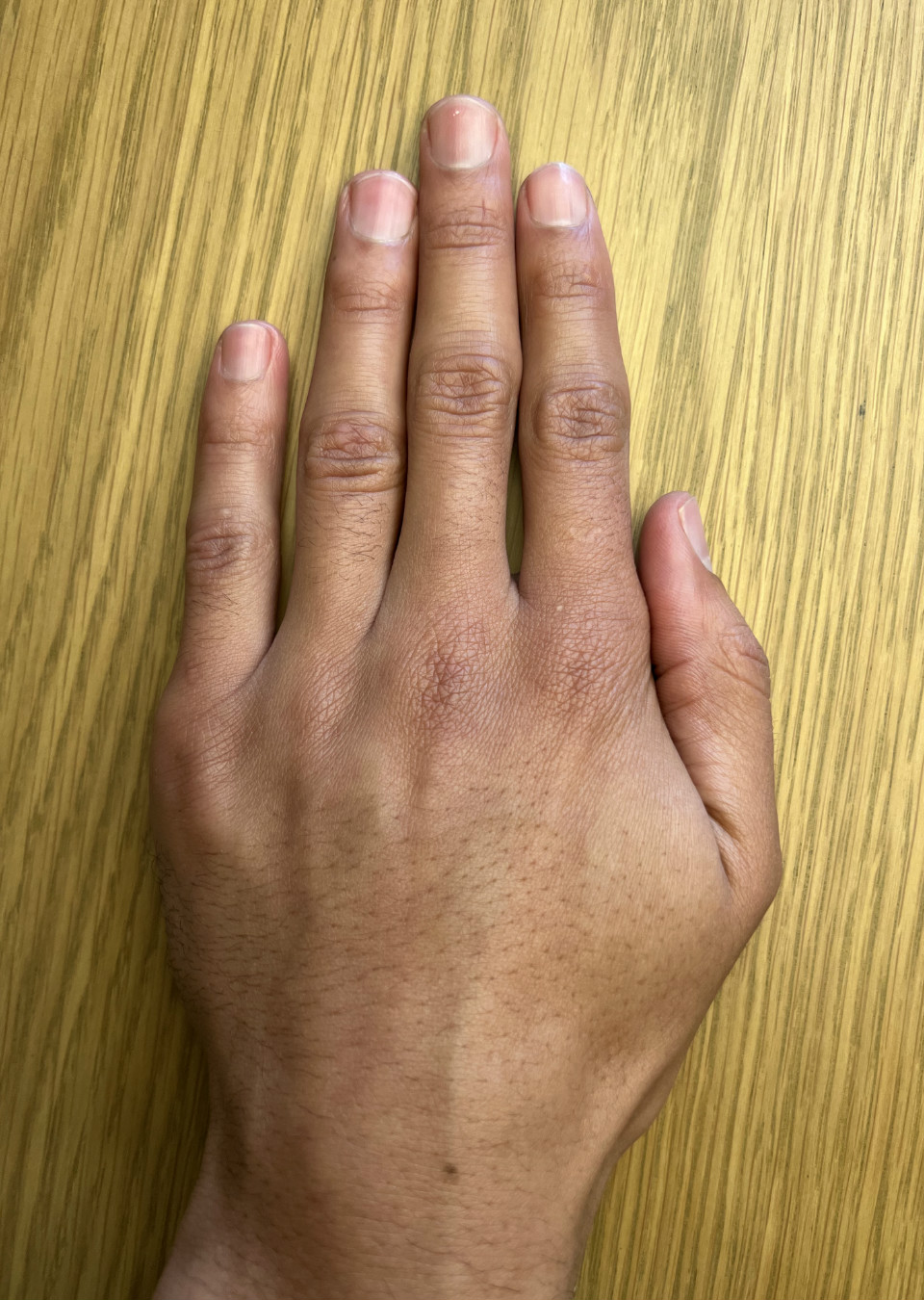 Bruno Hand models The Specials