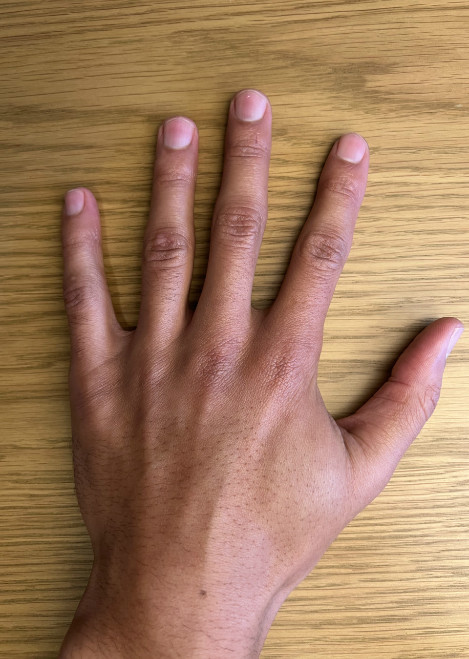 Bruno Hand models The Specials