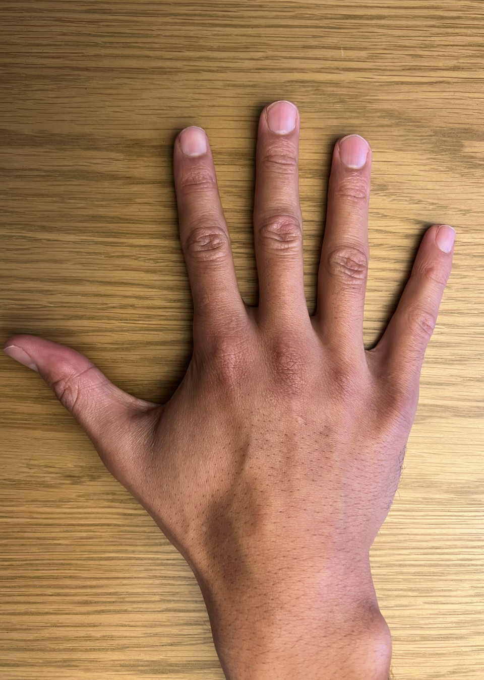 Bruno Hand models The Specials