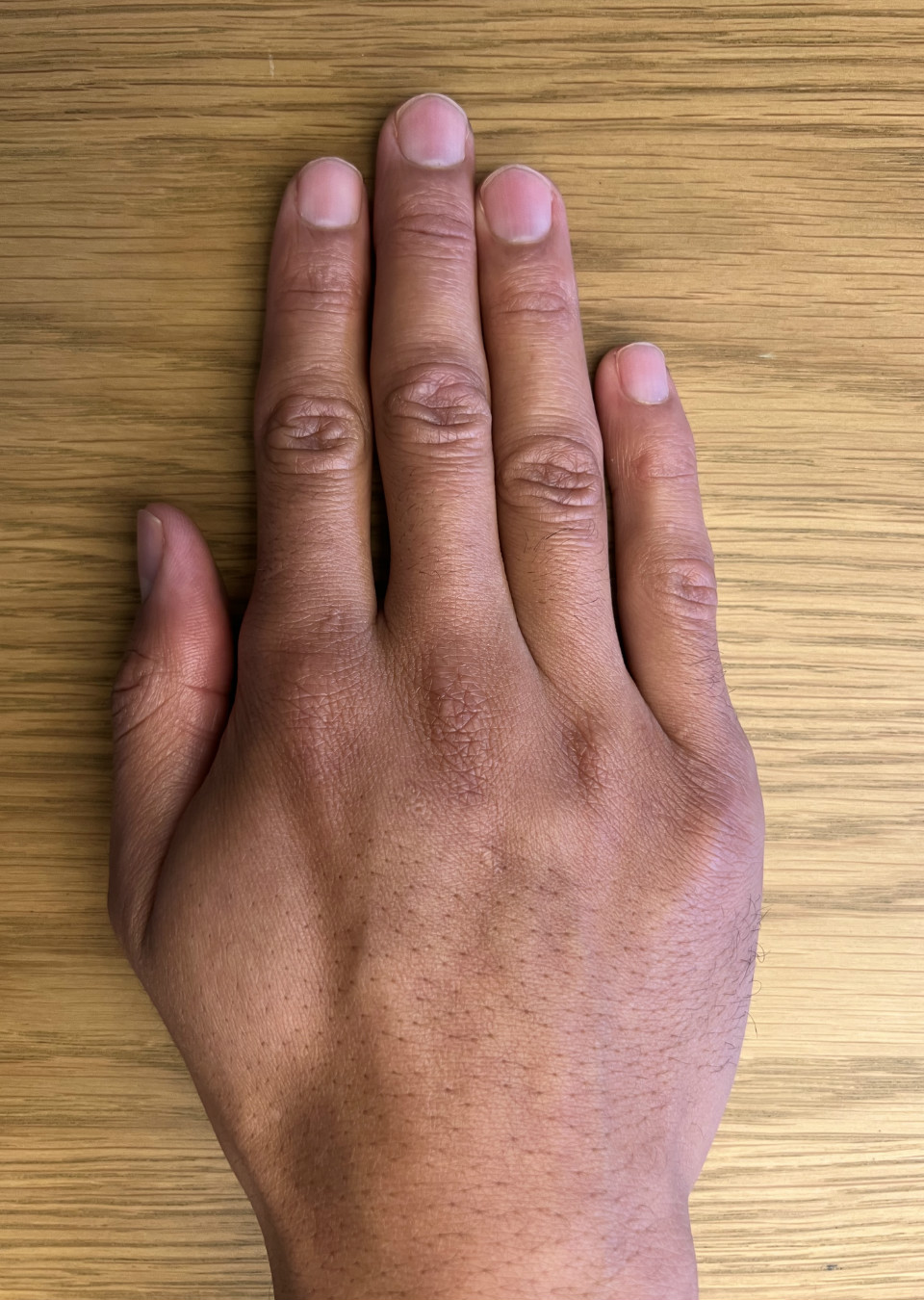 Bruno Hand models The Specials