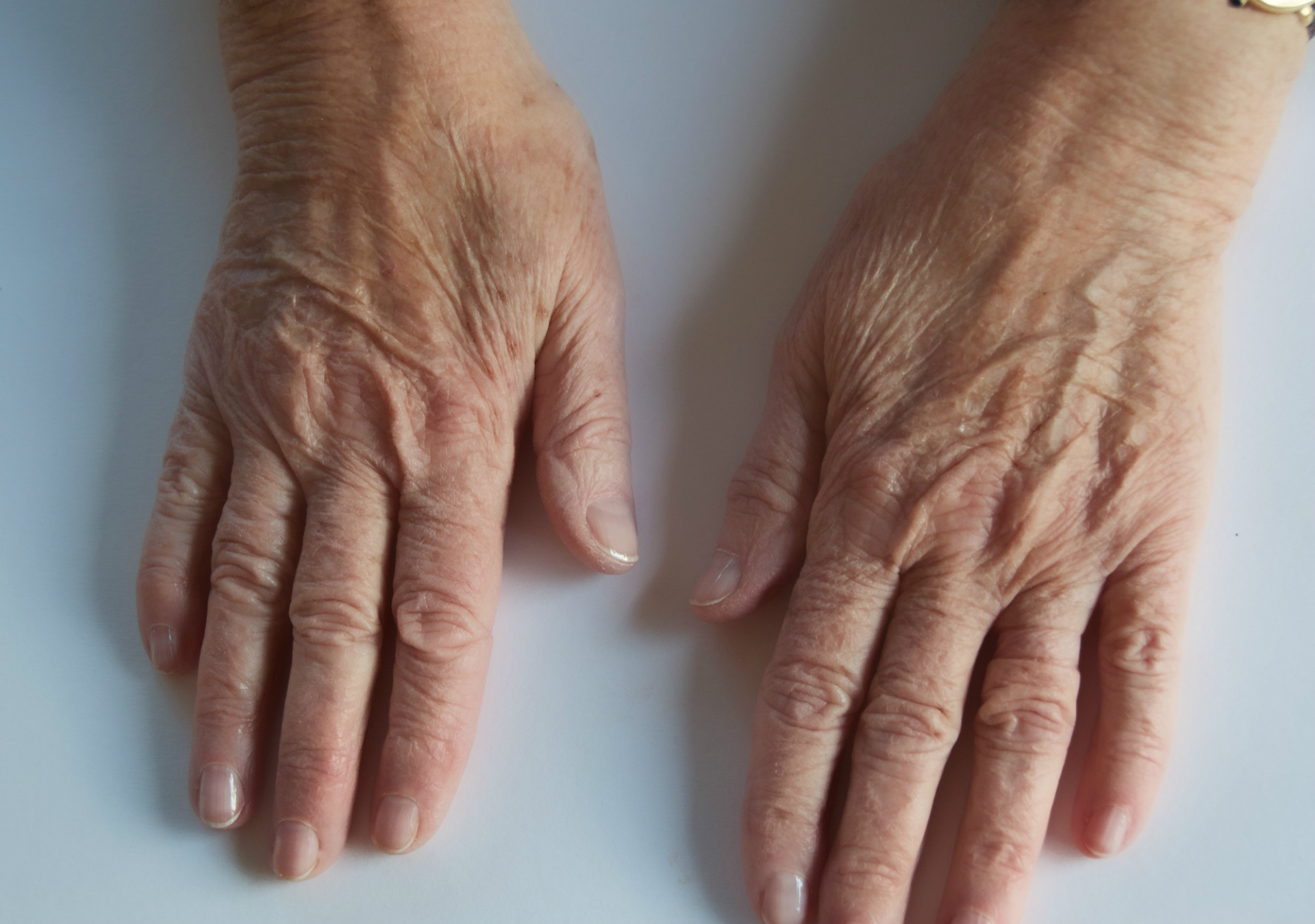 IRENE Hand models The Specials